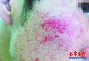 �����Ϲ�ޱ����ë�����沿���� ���������