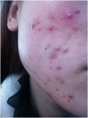���޼�2000Ԫ�Ŷ����ղ�Ʒ�ú�ŧ��(ͼ)