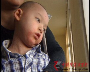 315�طã������Ÿ�ͷ���� ����ҩˮ��������